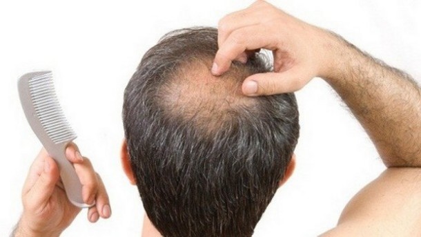 stop hair loss-regrow hair blogspot